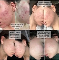 Consultation médicale en ligne: dermatologie